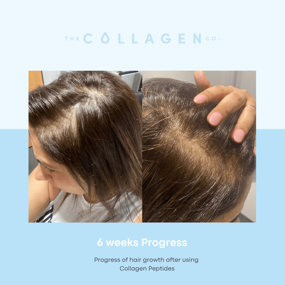 How Jeanette recovered from Postpartum and Virus-related hair loss - The Collagen Co.