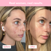 Ultimate Glow Up Bundle